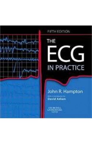 The ECG in Practice